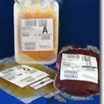 Correct Procedure for Blood Transfusion and Transfusion of Blood Products