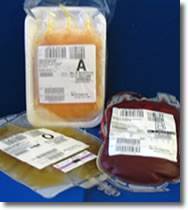 Correct Procedure for Blood Transfusion and Transfusion of Blood Products