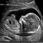 Obstetricians Gynaecologists ( DGO MD OG MS OG ) permitted to do USG Obstetric Pregnancy Ultrasound Scan