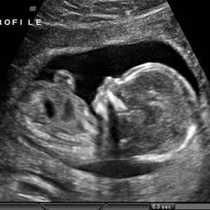 Obstetricians Gynaecologists ( DGO MD OG MS OG ) permitted to do USG Obstetric Pregnancy Ultrasound Scan 